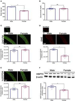 Impaired HSP70 Expression in the Aorta of Female Rats: A Novel Insight Into Sex-Specific Differences in Vascular Function